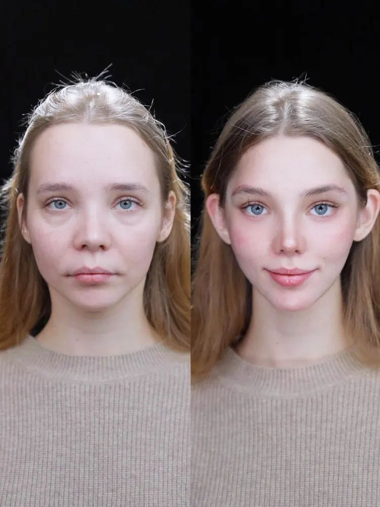 Elf ears - before and after