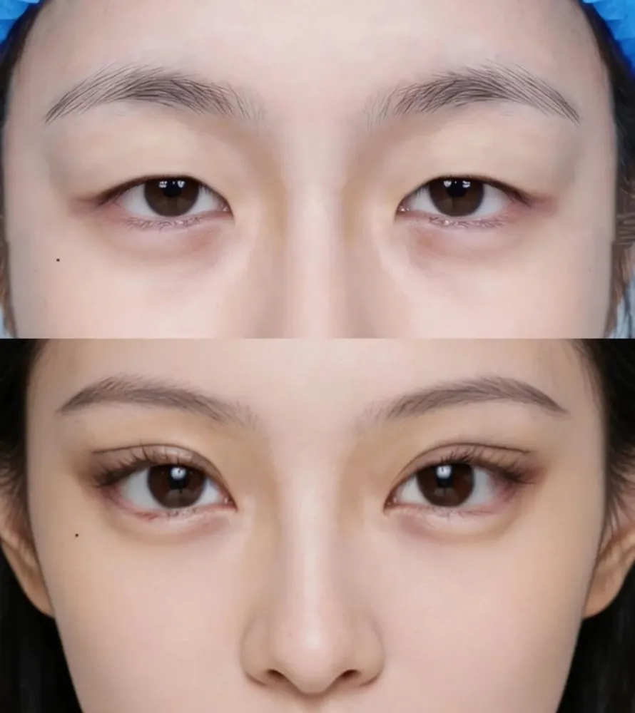 Fox eyes - before and after